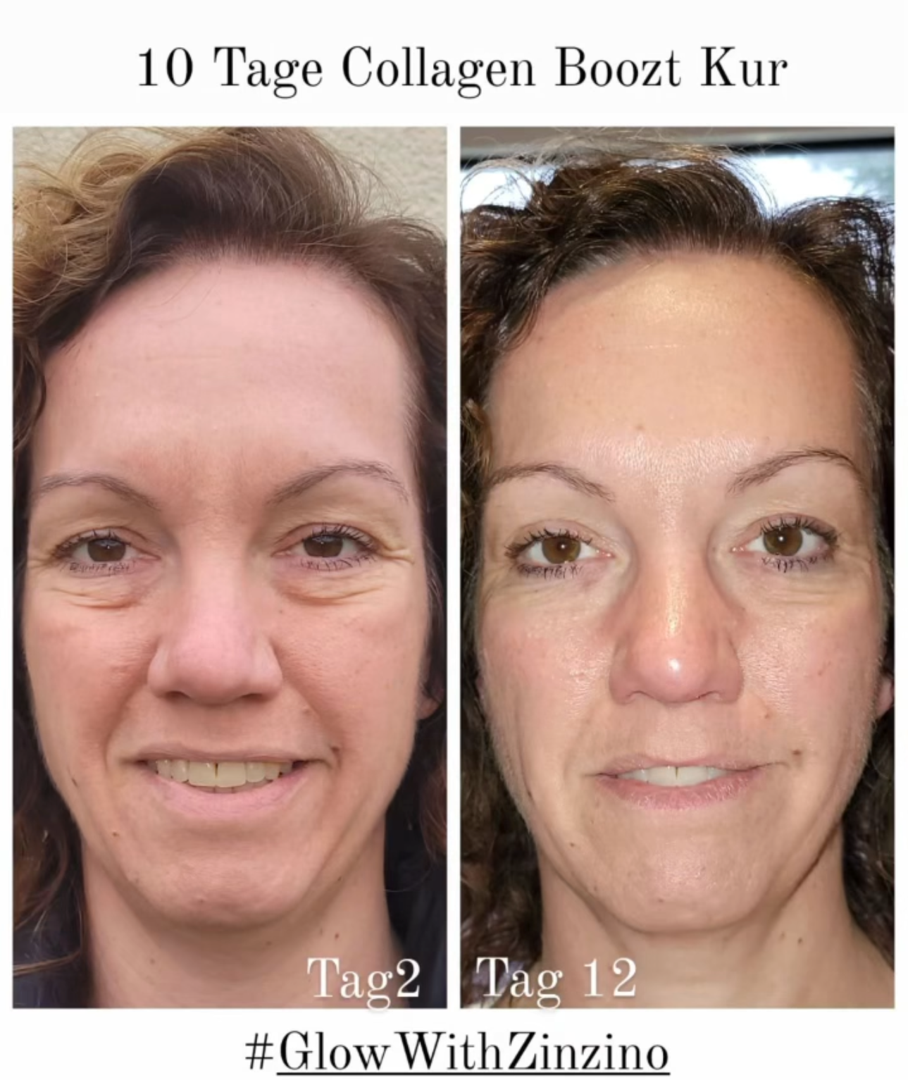 The benefits of marine collagen The benefits of marine collagen 1