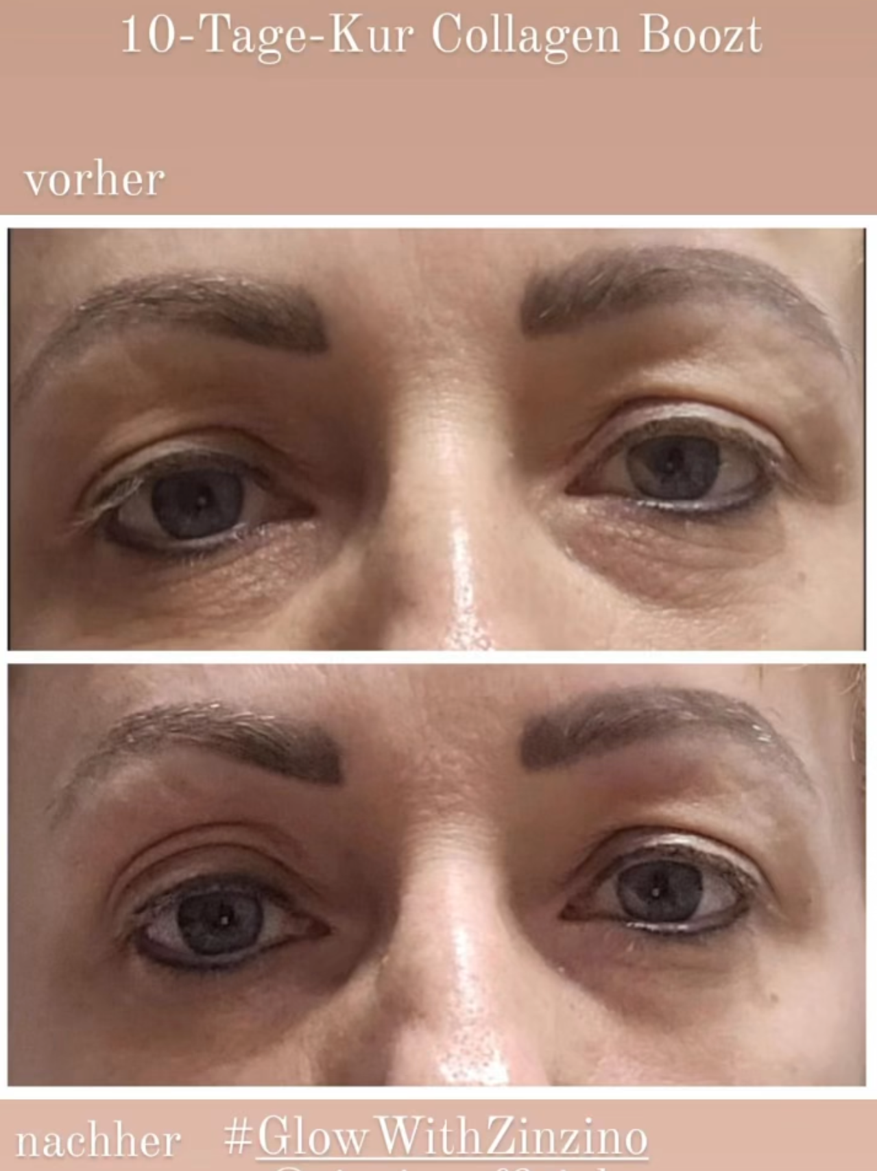 The benefits of marine collagen 3 the benefits of marine collagen