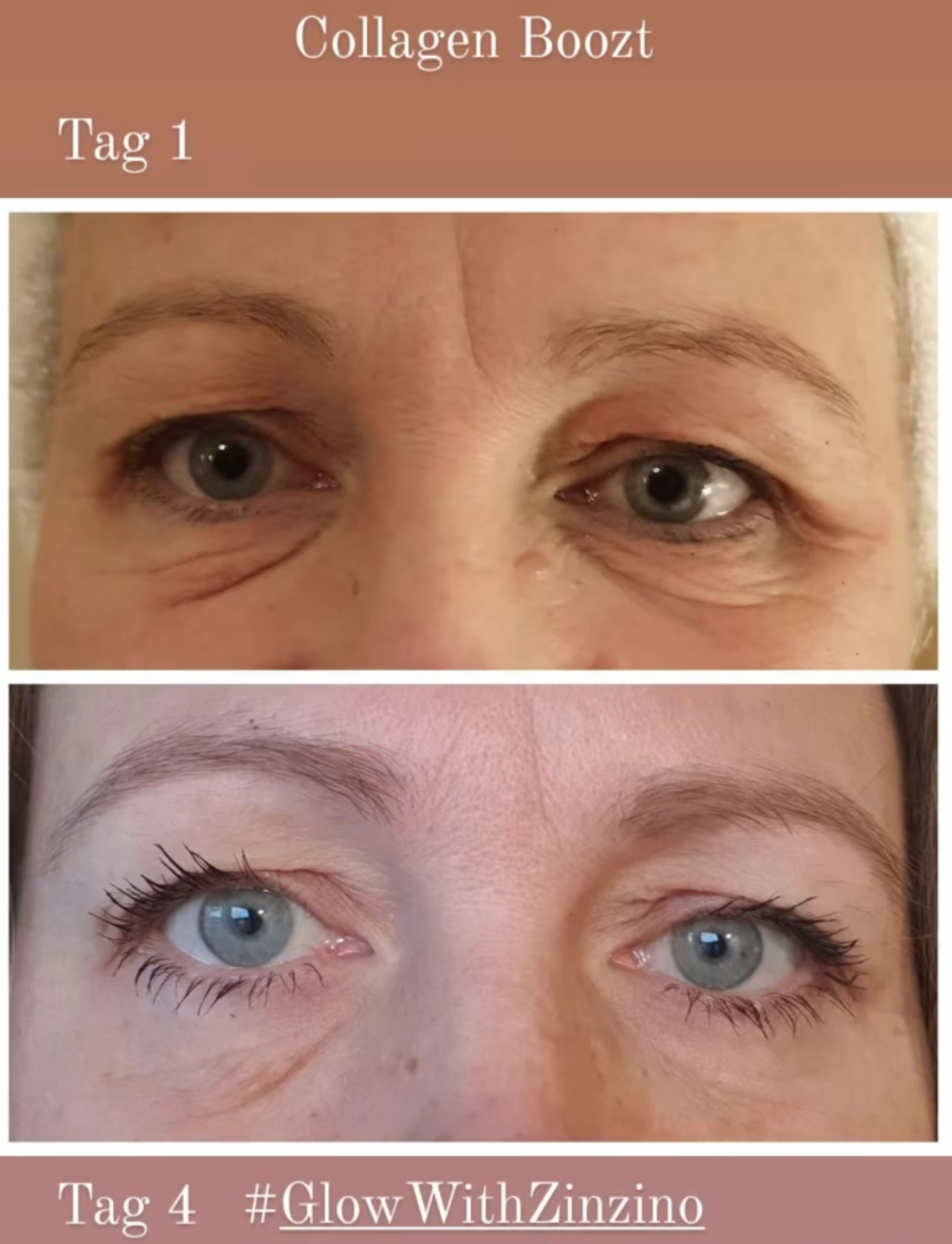 The benefits of marine collagen 4 the benefits of marine collagen